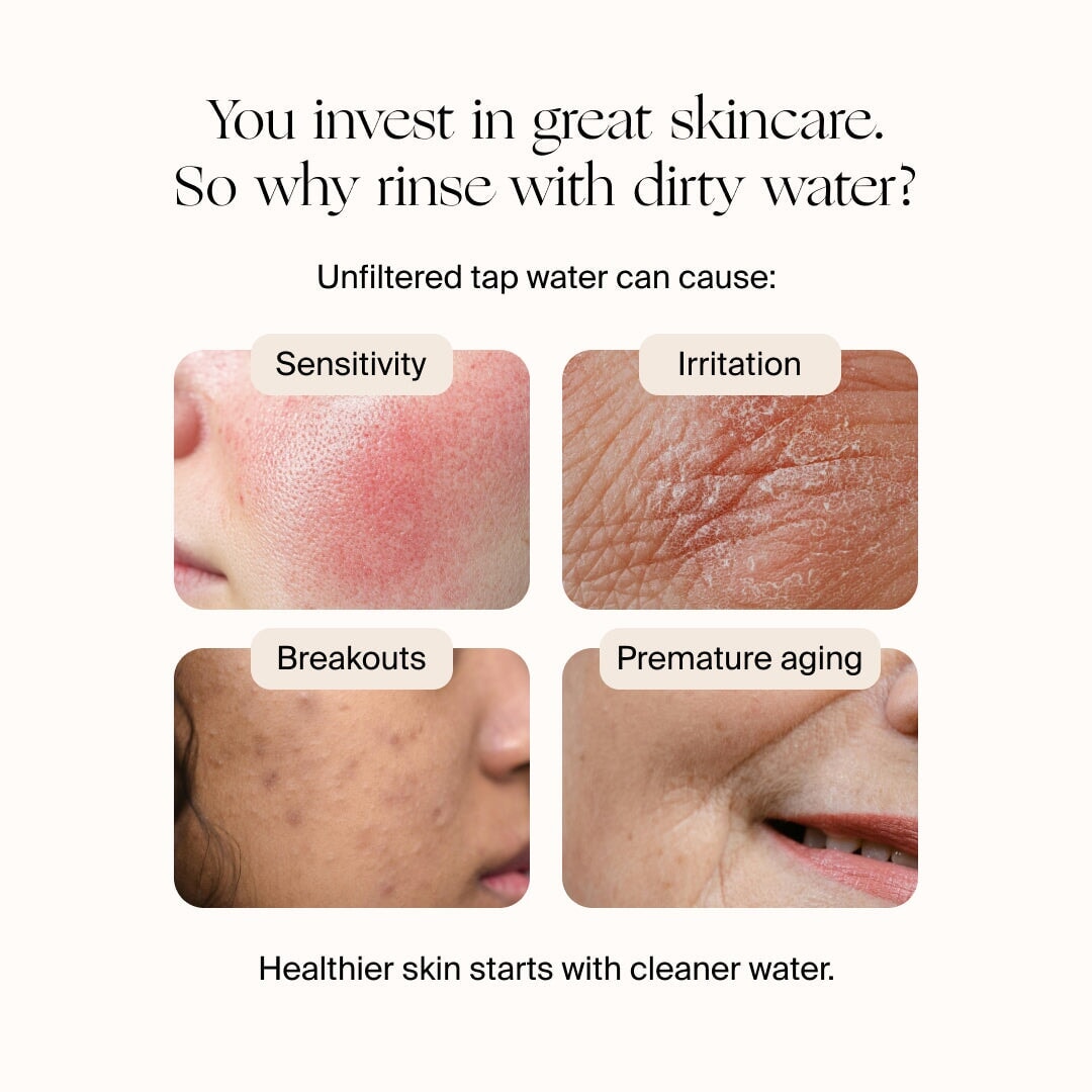 Canopy Faucet Filter ad highlights how unfiltered tap water can cause sensitivity, irritation, breakouts, and premature aging, with close-up images depicting each skin issue. Fulfilled by Canopy.