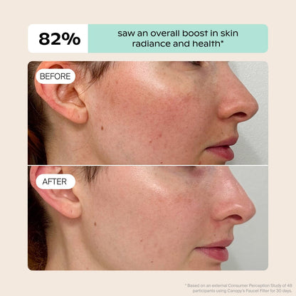 Split image shows a tap before and after using the Canopy Faucet Filter; the "after" side displays clearer, healthier water. Text notes 82% saw improved water clarity and quality. Fulfilled by Canopy.