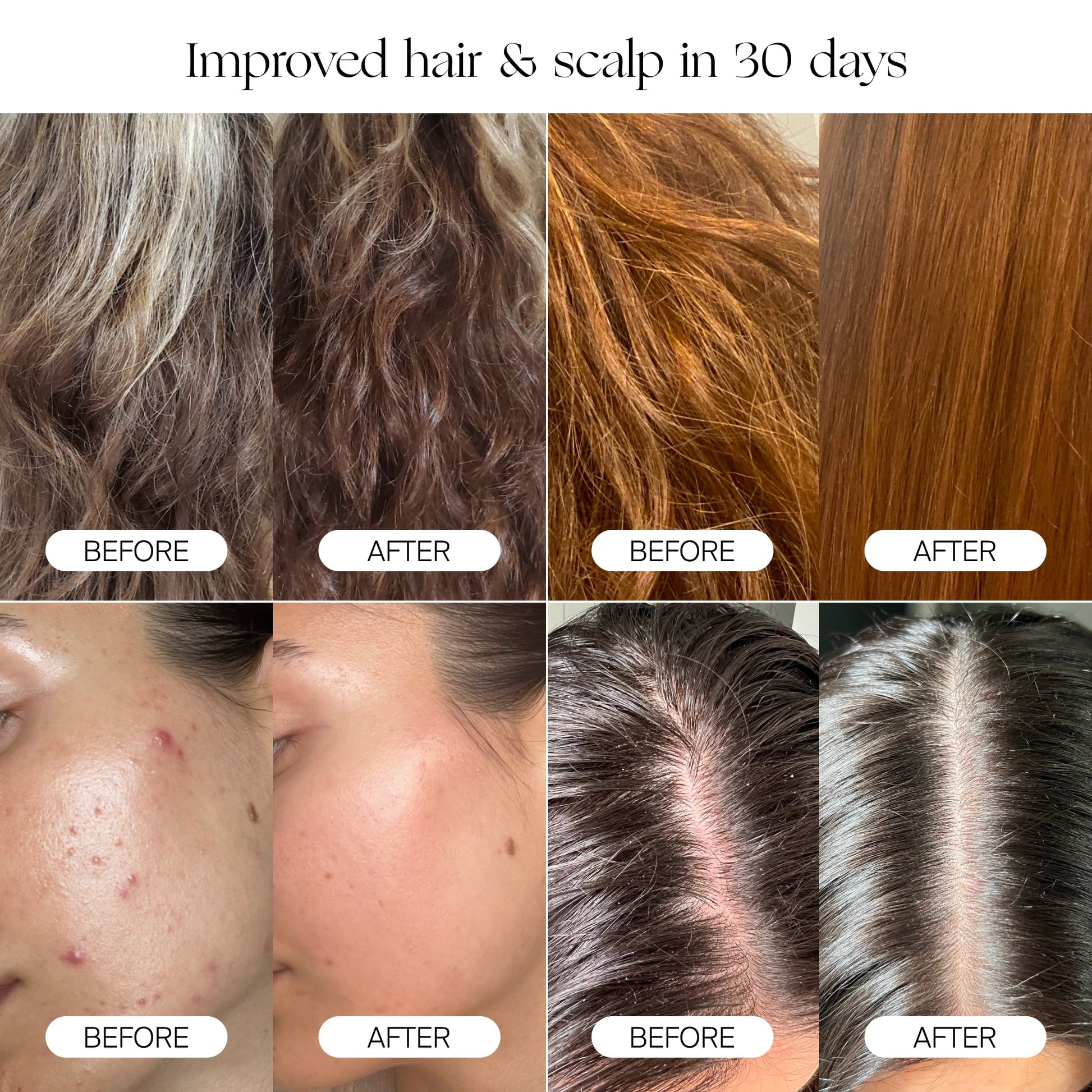 A collage of before-and-after photos highlights hair texture, scalp condition, and facial skin clarity improvements over 30 days with the Canopy Filtered Showerhead. Each pair displays "before" on the left and "after" on the right.
