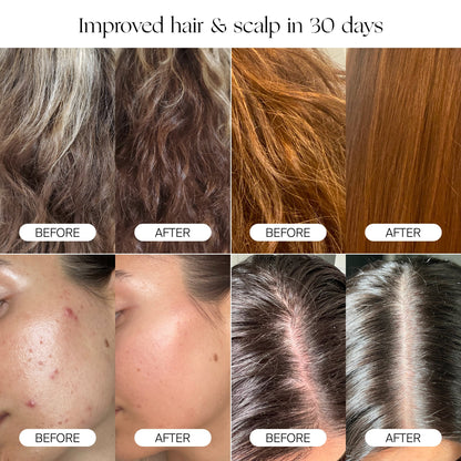 A collage of before-and-after photos highlights hair texture, scalp condition, and facial skin clarity improvements over 30 days with the Canopy Filtered Showerhead. Each pair displays "before" on the left and "after" on the right.