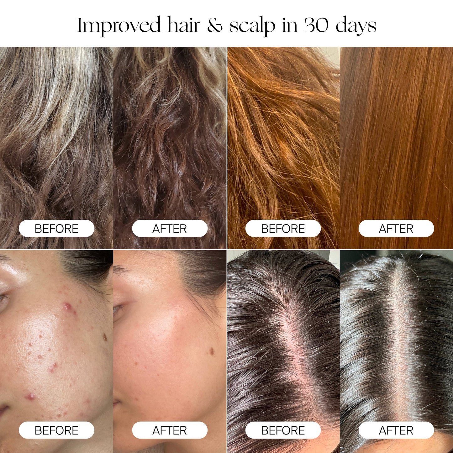 A collage shows before and after images of hair, scalp, and skin—thanks to the Canopy Handheld Filtered Showerhead. After 30 days, hair looks smoother, scalps are clearer, and skin appears healthier. Text: "Improved hair & scalp in 30 days.