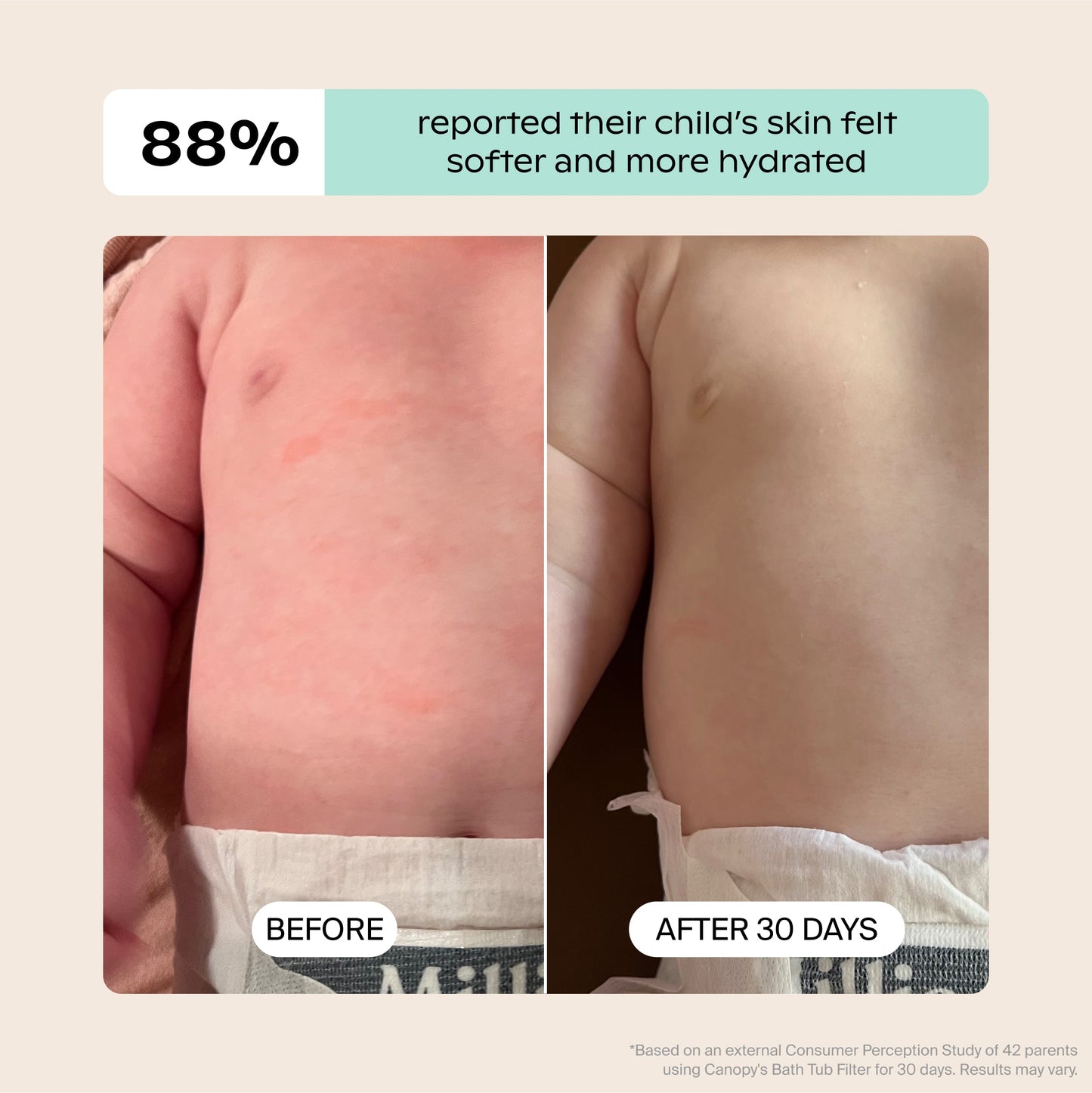 White Lavender Jade Butter Seafoam Oat
Side-by-side baby torso photos show results before and after 30 days using the Canopy Baby Bath Tub Filter. The "before" image shows red dryness; "after" reveals smoother skin. 88% reported improved hydration. Fulfilled by Canopy.