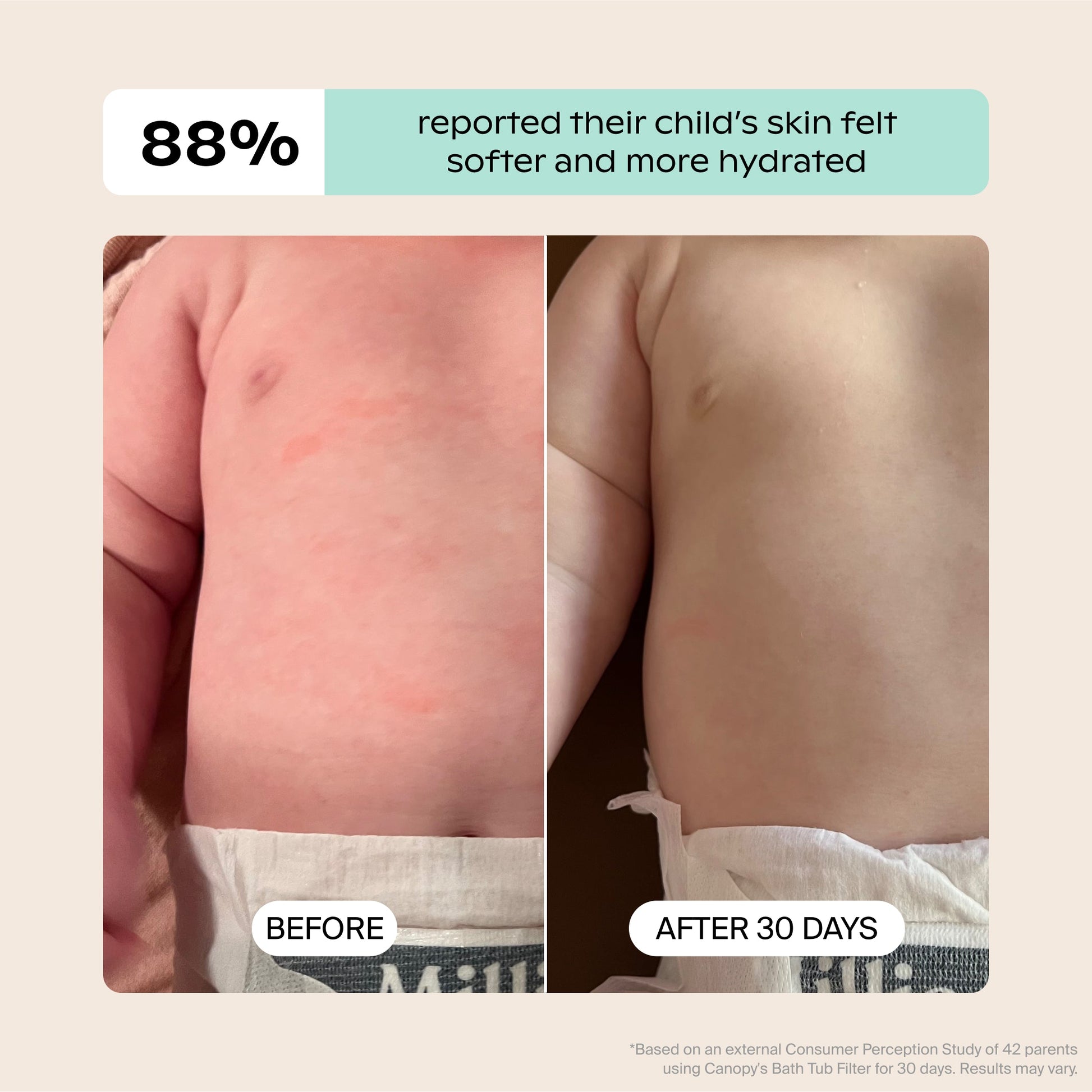 White Lavender Jade Butter Seafoam Oat
Side-by-side baby torso photos show results before and after 30 days using the Canopy Baby Bath Tub Filter. The "before" image shows red dryness; "after" reveals smoother skin. 88% reported improved hydration. Fulfilled by Canopy.