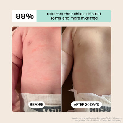 White Lavender Jade Butter Seafoam Oat
Side-by-side baby torso photos show results before and after 30 days using the Canopy Baby Bath Tub Filter. The "before" image shows red dryness; "after" reveals smoother skin. 88% reported improved hydration. Fulfilled by Canopy.