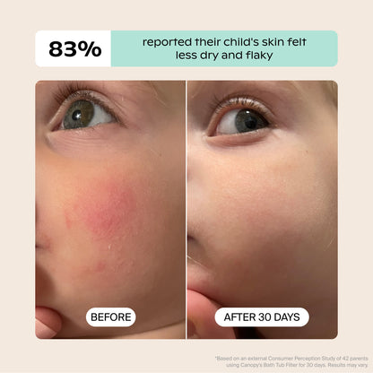 White Lavender Jade Butter Seafoam Oat
Side-by-side close-ups of a child's cheek show red, dry skin labeled "BEFORE" and smoother skin labeled "AFTER 30 DAYS." Above: 83% said their child’s skin felt less dry using the Canopy Baby Bath Tub Filter. Fulfilled by Canopy.
