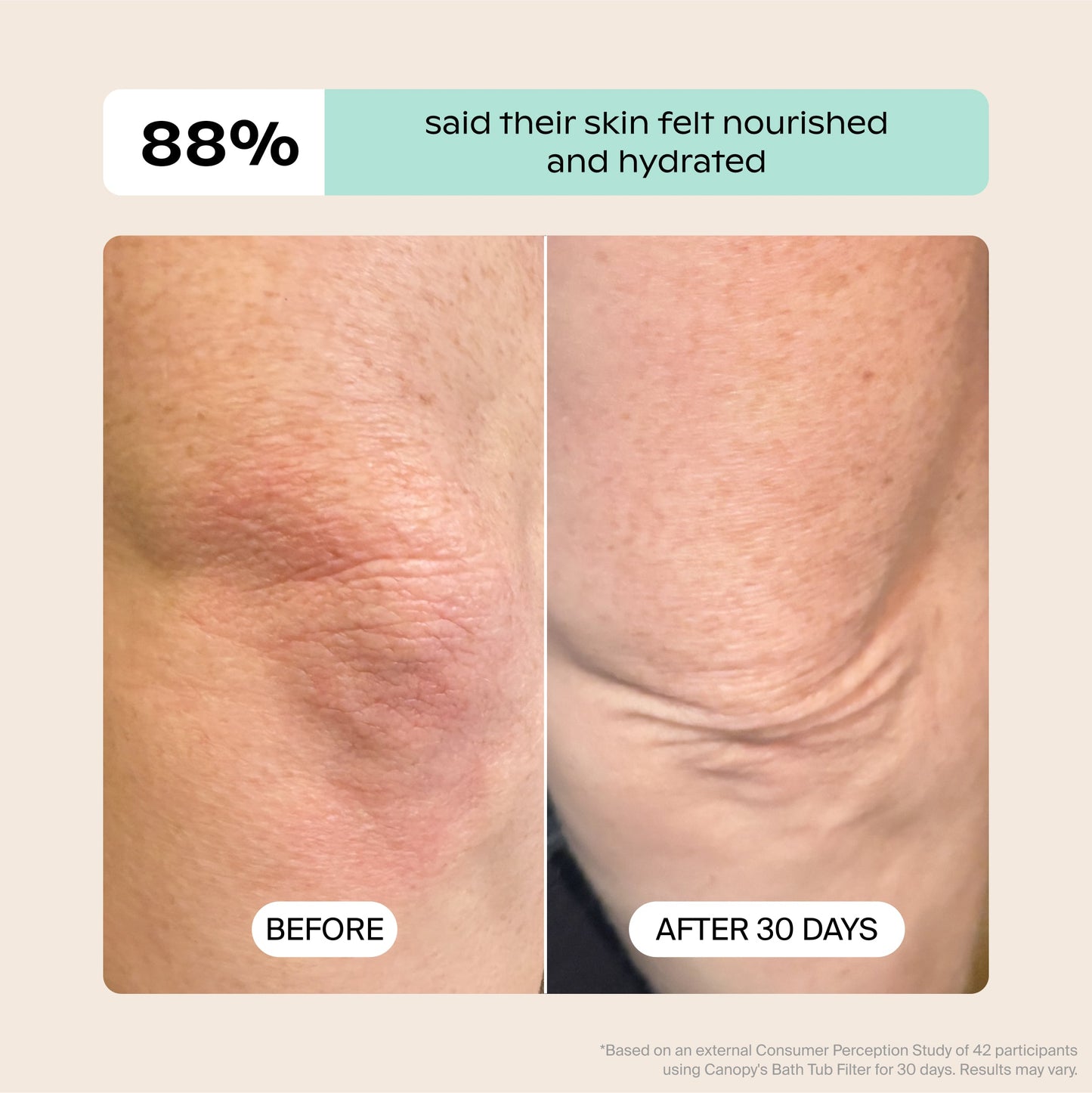 A side-by-side shows dry skin labeled "BEFORE" and smoother, hydrated skin after 30 days using the Canopy Bath Tub Filter. Text above reads: "88% said their skin felt nourished and hydrated." Fulfilled by Canopy.