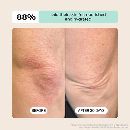 A side-by-side shows dry skin labeled "BEFORE" and smoother, hydrated skin after 30 days using the Canopy Bath Tub Filter. Text above reads: "88% said their skin felt nourished and hydrated." Fulfilled by Canopy.