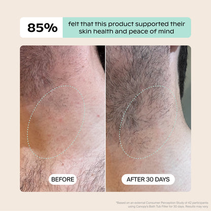 Before-and-after photos of the back of a person's neck show visible skin improvement with Canopy Bath Tub Filter. "Before" has redness; "After 30 Days" shows clearer skin. 85% felt this product supported their skin health.